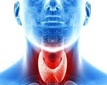 甲狀腺腫大是「常見病」究竟切定唔切?